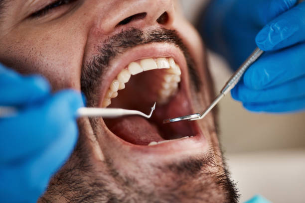 Best Pediatric Emergency Dentist in Bronson, FL